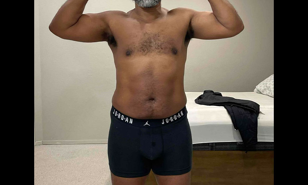 After Transformation 2