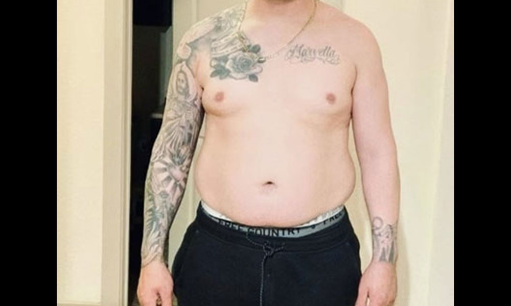 Before Transformation 1