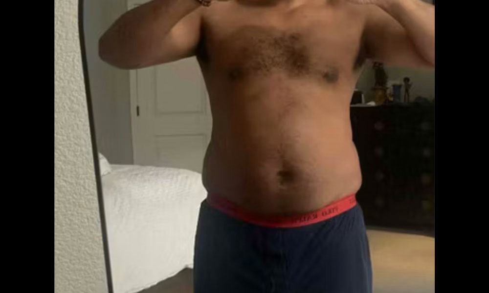 Before Transformation 2